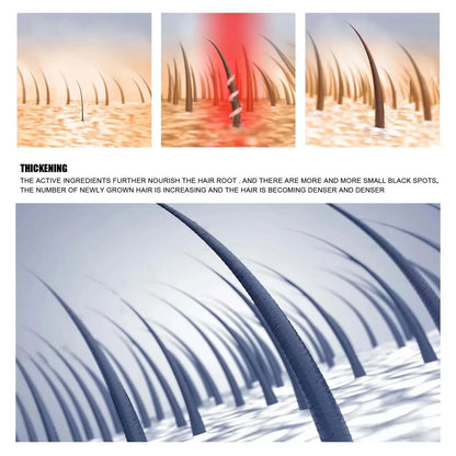 Fast Hair Growth Oil - Anti Hair Loss Treatment for Baldness, Thinning & Postpartum Hair Loss