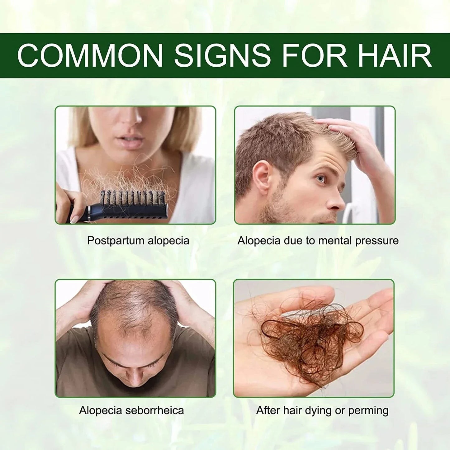 Fast Hair Growth Oil - Anti Hair Loss Treatment for Baldness, Thinning & Postpartum Hair Loss