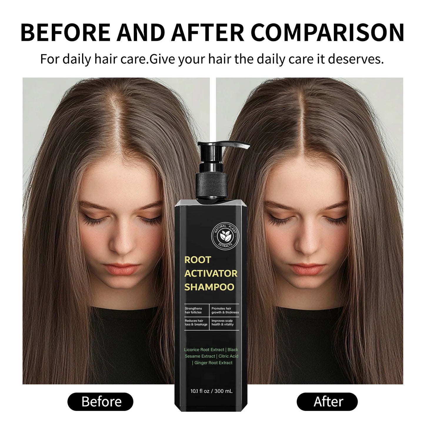 Hair Root Activator Shampoo 300ml - Nourish Roots, Strengthen Follicles & Promote Growth