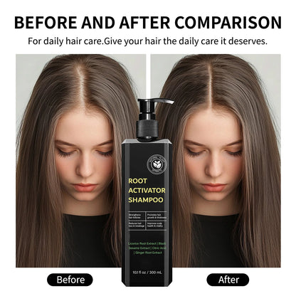 Hair Root Activator Shampoo 300ml - Nourish Roots, Strengthen Follicles & Promote Growth