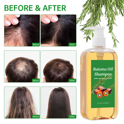 Hair Growth Shampoo 300ml - Batana Oil & Rosemary for Frizz Control, Breakage Prevention & Scalp Nourishment