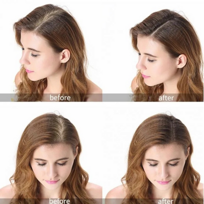 GingerGrow™ Professional Hair Care Kit